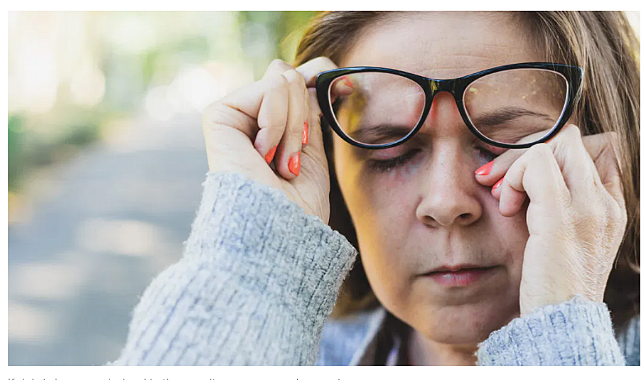 Gözde alerji kolaylıkla tedavi edilebilen bir hastalıktır